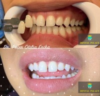 Dental Palace Dental Palace