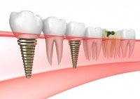 Dental Palace Dental Palace