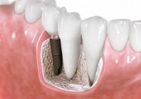 Dental Palace Dental Palace