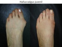 Uscatu Marius - Centrul de Chirurgia Ante-Piciorului Uscatu Marius - Centrul de Chirurgia Ante-Piciorului