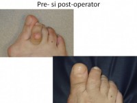Uscatu Marius - Centrul de Chirurgia Ante-Piciorului